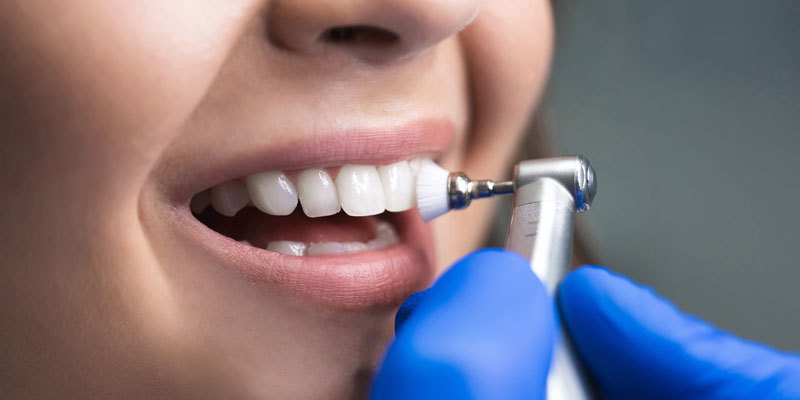 laser teeth whitening cost
