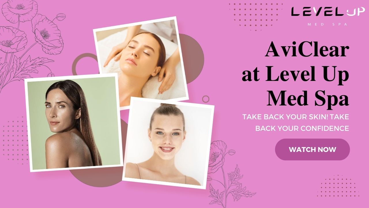 acne scars laser treatment North Andover MA 01845
