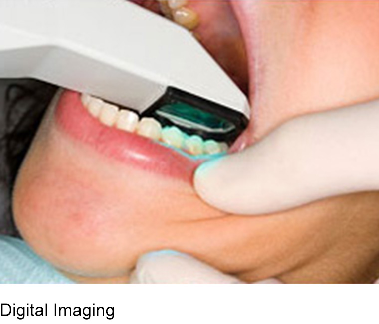 who does same day dental implants