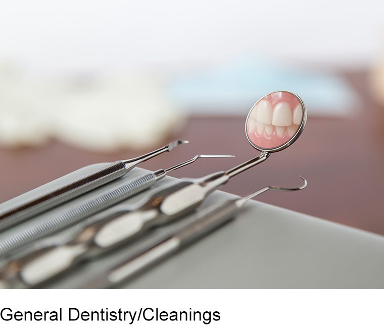 all on 4 dental implants