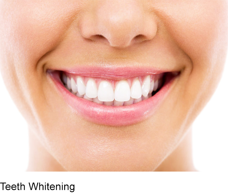 before and after dental implants