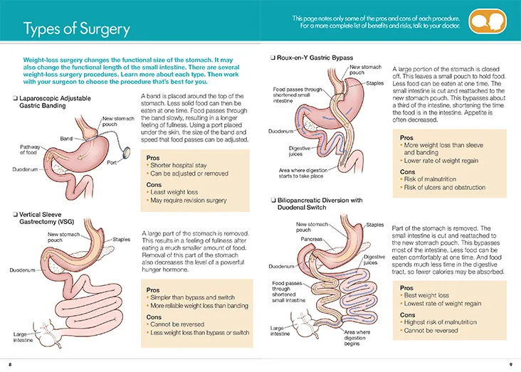 Bariatric Meal Plans