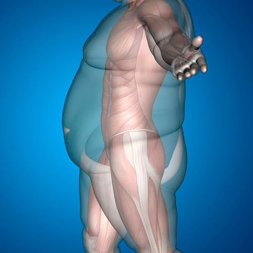 Bariatric Multivitamin