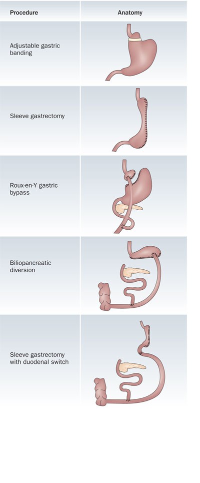 Best Chewable Bariatric Vitamins