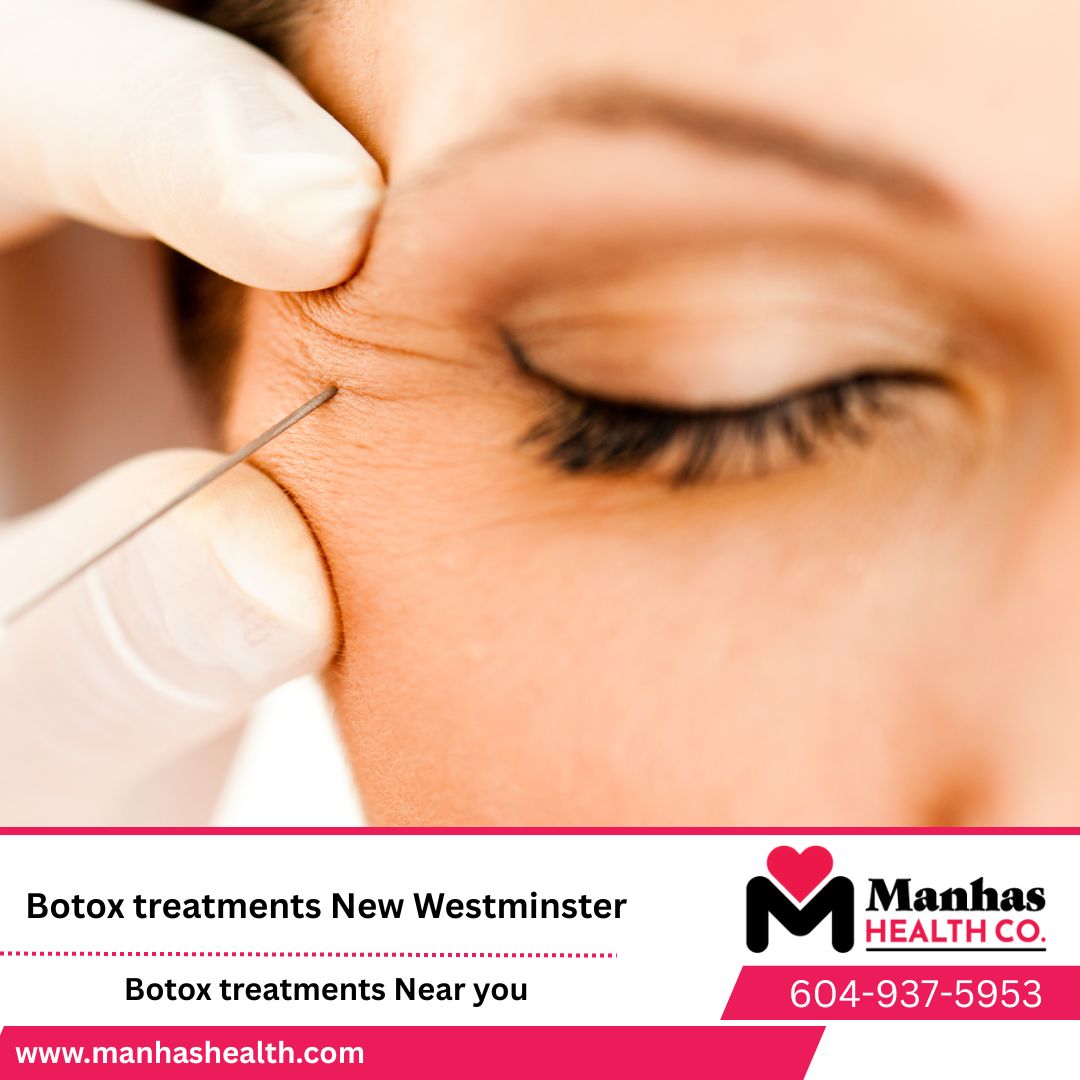 Botox and Filler before and after