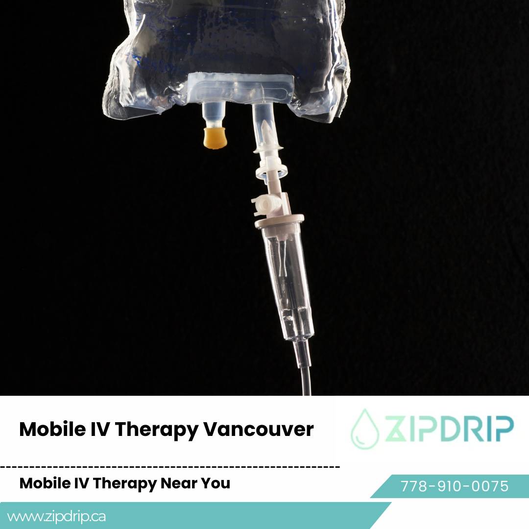 IV Vitamin Therapy Vancouver IV Hydration Drip Service
