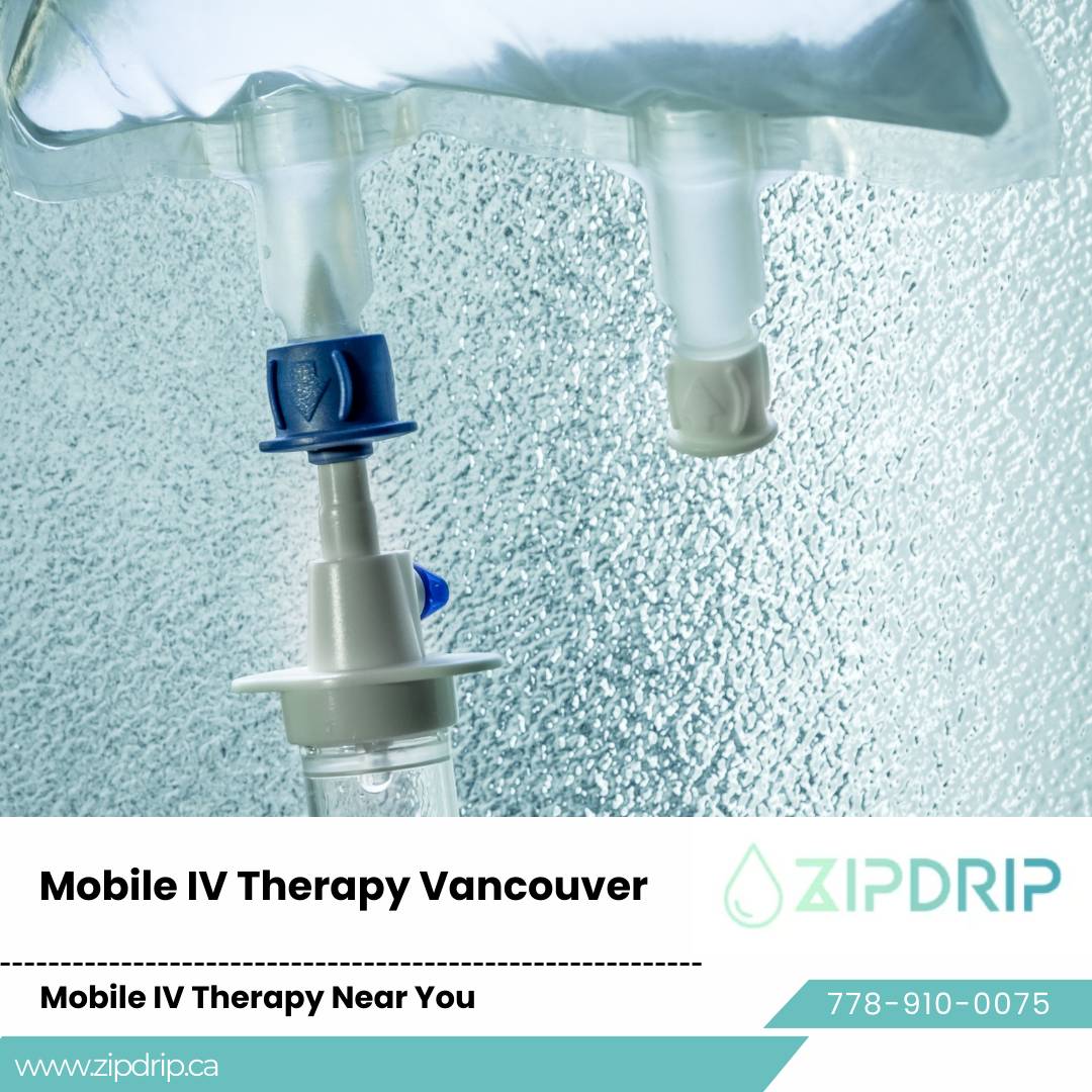 Vitamin drip clinic Vancouver Mobile IV Drip Service
