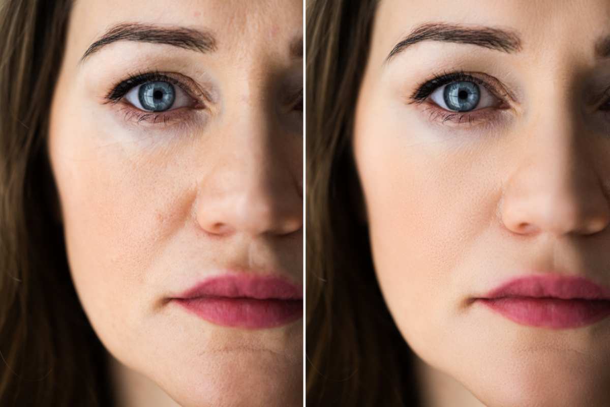 Eyelash Extension In Los Angeles Ca