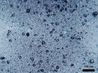Mikroplastik